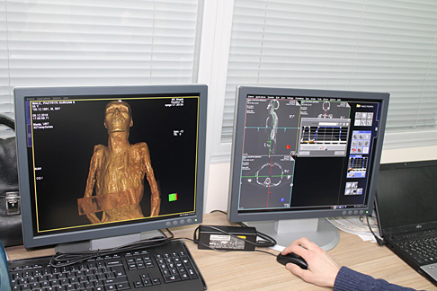 Алтайским мумиям из Эрмитажа сделали томографию